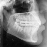 Radiologia Odontológica em Porto Velho